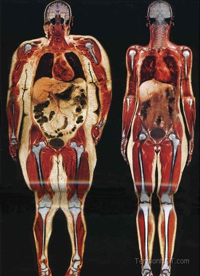 fat-and-skinny-comparison